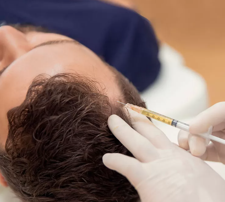microneedling with prp Beverly Hills